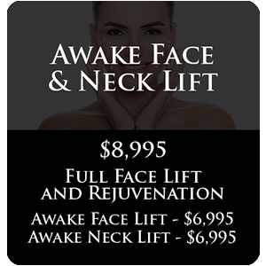 Awake Face & Neck Lift Awake Face & Neck Lift